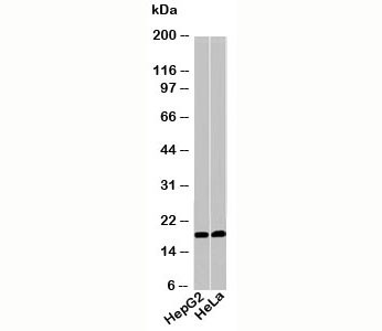 Anti-Acid Phosphatase / ACP1