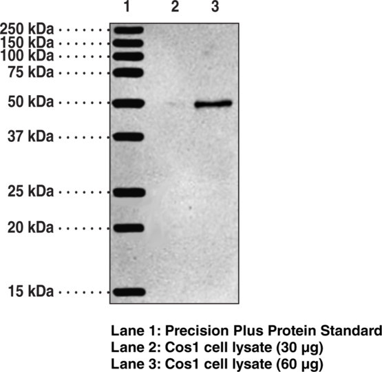 Anti-5-OxoETE Receptor