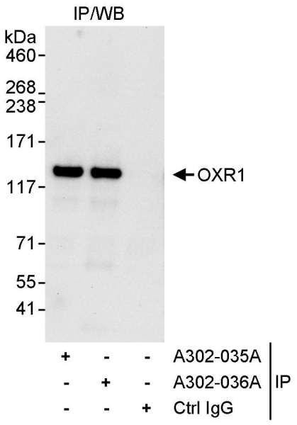 Anti-OXR1