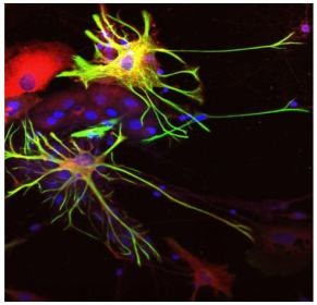 Anti-ALDH1L1