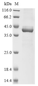 Epoxide hydrolase 3 (EPHX3), partial, human, recombinant