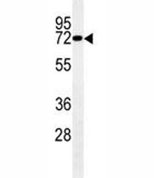 Anti-LIM Kinase 1 / LIMK1, clone 175CT3.2.5
