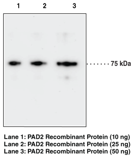 Anti-PAD2 (Clone 9F7)