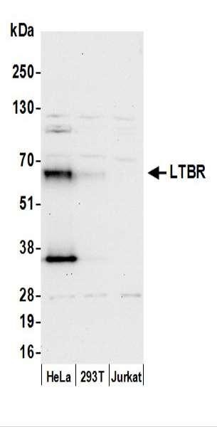 Anti-LTBR/Lymphotoxin-beta Receptor