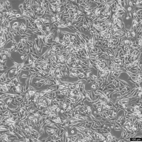 HMY-1 Cells