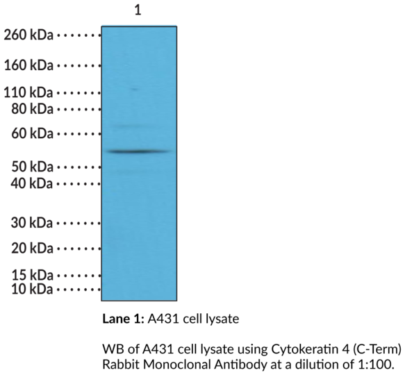 Anti-Cytokeratin 4 (C-Term) Rabbit Monoclonal Antibody (Clone RM355)