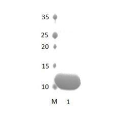 SYNJ2BP PDZ Domain