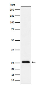Anti-INMT / TEMT, clone 29I89