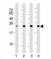 Anti-Superoxide Dismutase 2 Antibody (SOD2), clone 37CT127.5.11.6