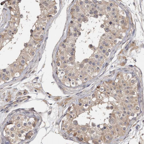 Anti-TTC39A