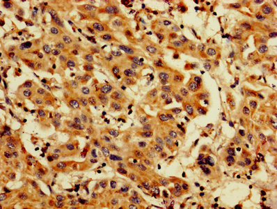 Anti-PDCD6