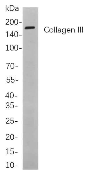Anti-Recombinant Collagen III, clone 6A3