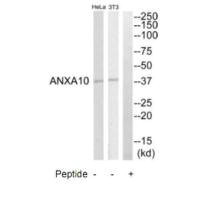 Anti-ANXA10