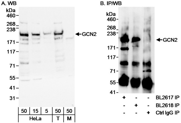 Anti-GCN2