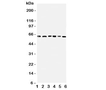 Anti-PDK1