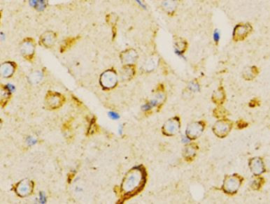 Anti-VARS / valyl tRNA synthetase