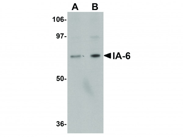 Anti-IA-6