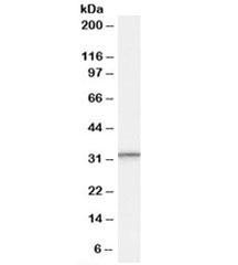 Anti-PSME1