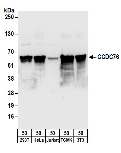 Anti-CCDC76