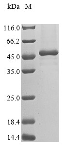 Melanoma-associated antigen B2 (MAGEB2), human, recombinant