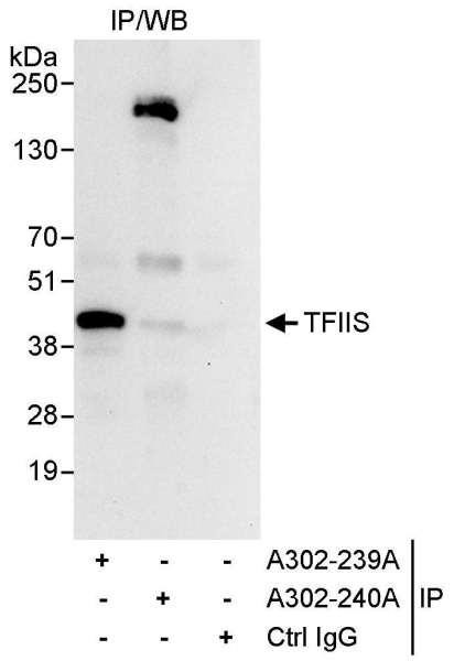 Anti-TFIIS