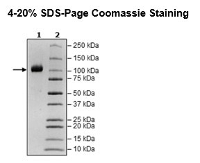 ACE2, His-Tag, Eu-labeled