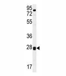 Anti-TOR2A