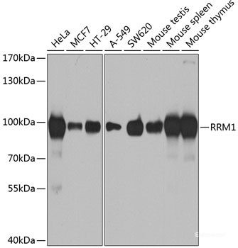 Anti-RRM1