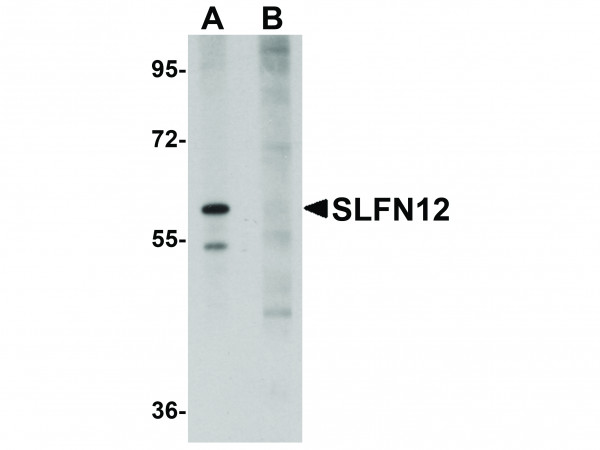 Anti-SLFN12
