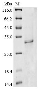 Protein Wiz (WIZ), partial, human, recombinant