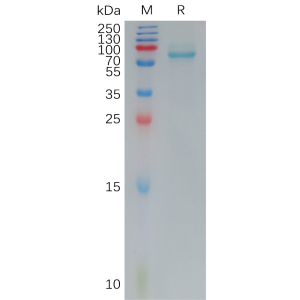 Human FZD7 Protein, hFc Tag