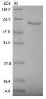 Zona pellucida sperm-binding protein 3 (ZP3), partial, human, recombinant