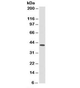 Anti-HLA-ABC (MHC I), clone 246-B8.E7