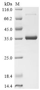 Lymphocyte antigen 6E (LY6E), recombinant human