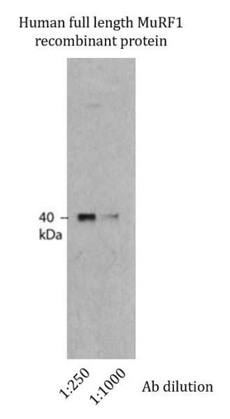 Anti-TRIM63 / MuRF1, clone M316