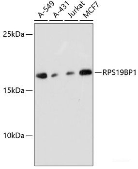 Anti-RPS19BP1