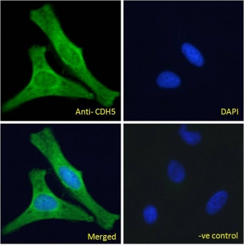 Anti-Cadherin 5 / VE Cadherin