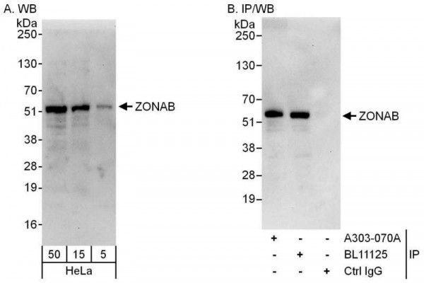 Anti-ZONAB