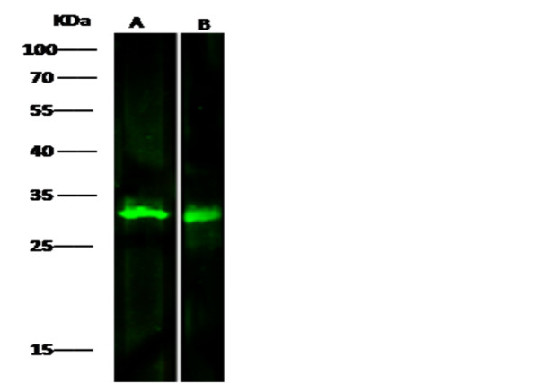 Anti-METTL1 Monoclonal Antibody
