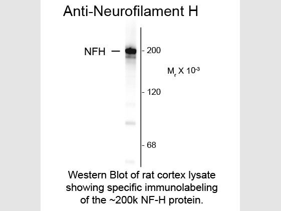 Anti-Neurofilament H, clone NAP4