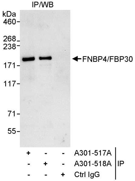 Anti-FNBP4/FBP30