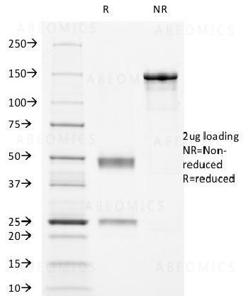 Anti-CD16 / FcγReceptor III Monoclonal Antibody (Clone: HuNK2)