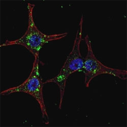 Anti-SYVN1 (HRD1)