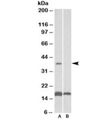 Anti-CD57