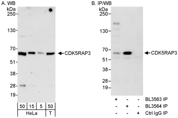 Anti-CDK5RAP3