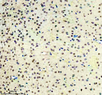 Anti-ISL1 / Islet 1, clone EHO-9