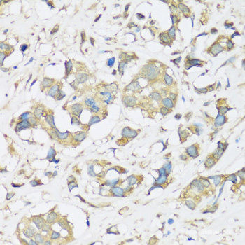 Anti-ATP2A3