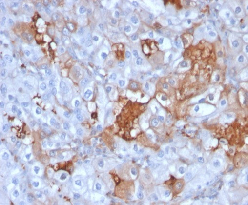 Anti-Cadherin-6 (CDH6) / K-Cadherin, clone CDH6/3191