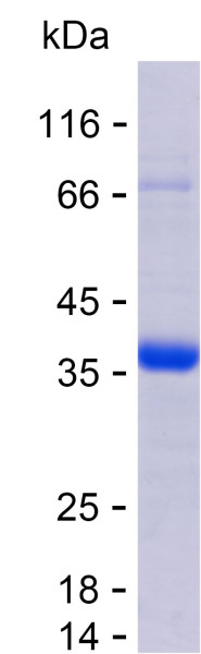 Recombinant Human B4GALT7 Protein