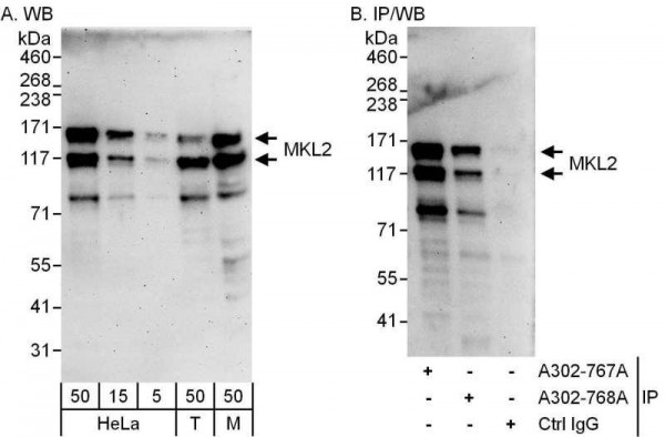 Anti-MKL2